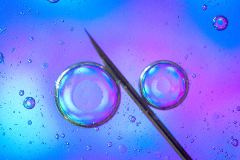 TESA ve PESA işlemlerinde kullanılan iğneyle sperm aspirasyonunu simgeleyen görsel
